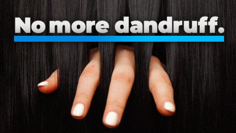 How to get rid of Dandruff NATURALLY